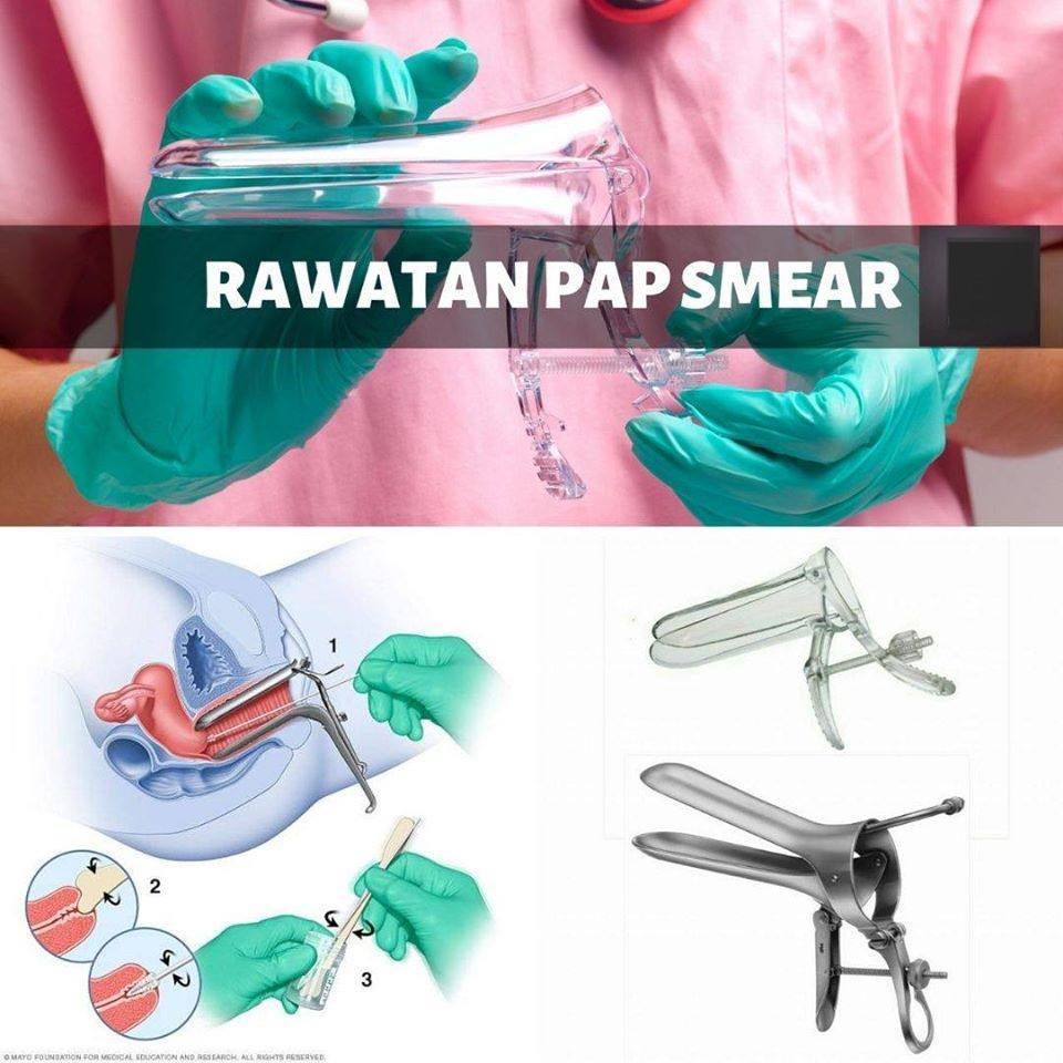 kepentingan ujian pap smear