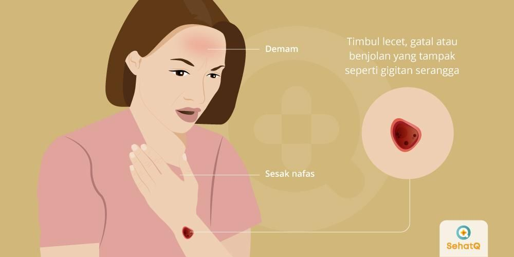 Gambar berkaitan maklumat penyakit antraks yang dijangkiti melalui haiwan