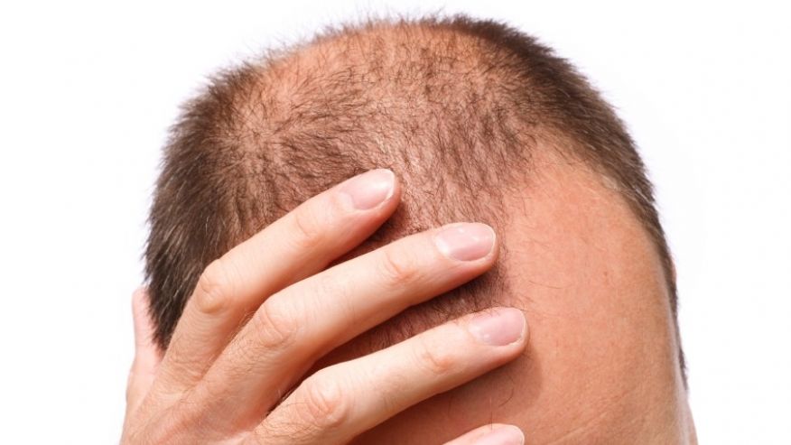 Pelbagai bahan semulajadi di dapur seperti aloe vera, santan kelapa, dan minyak kelapa untuk melebatkan rambut.