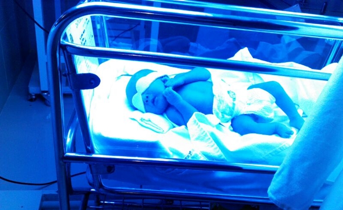 petua hilangkan kuning bayi