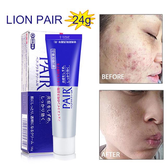 produk hilangkan parut jerawat