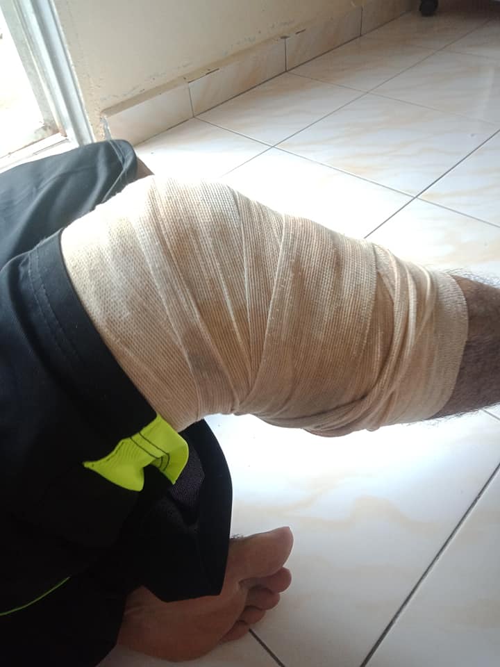 petua hilang sakit terseliuh