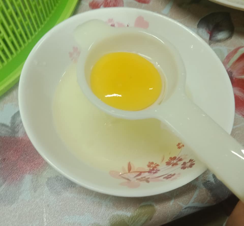petua hilang sakit terseliuh