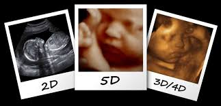 Gambar mesin ultrasound dan scan kandungan bayi di dalam rahim