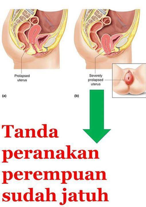 tanda rahim jatuh