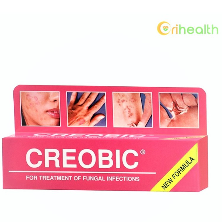 krim antifungal terbaik