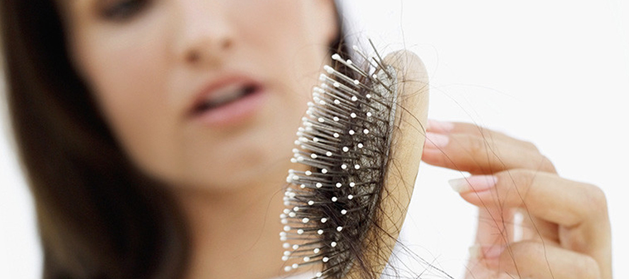 Wanita memegang rambut gugur kerana masalah keguguran rambut yang teruk.