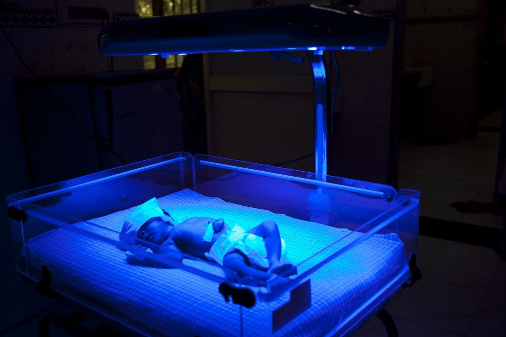 bacaan normal jaundice bayi