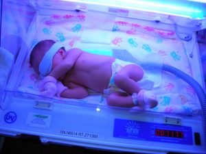 tips turunkan demam kuning bayi