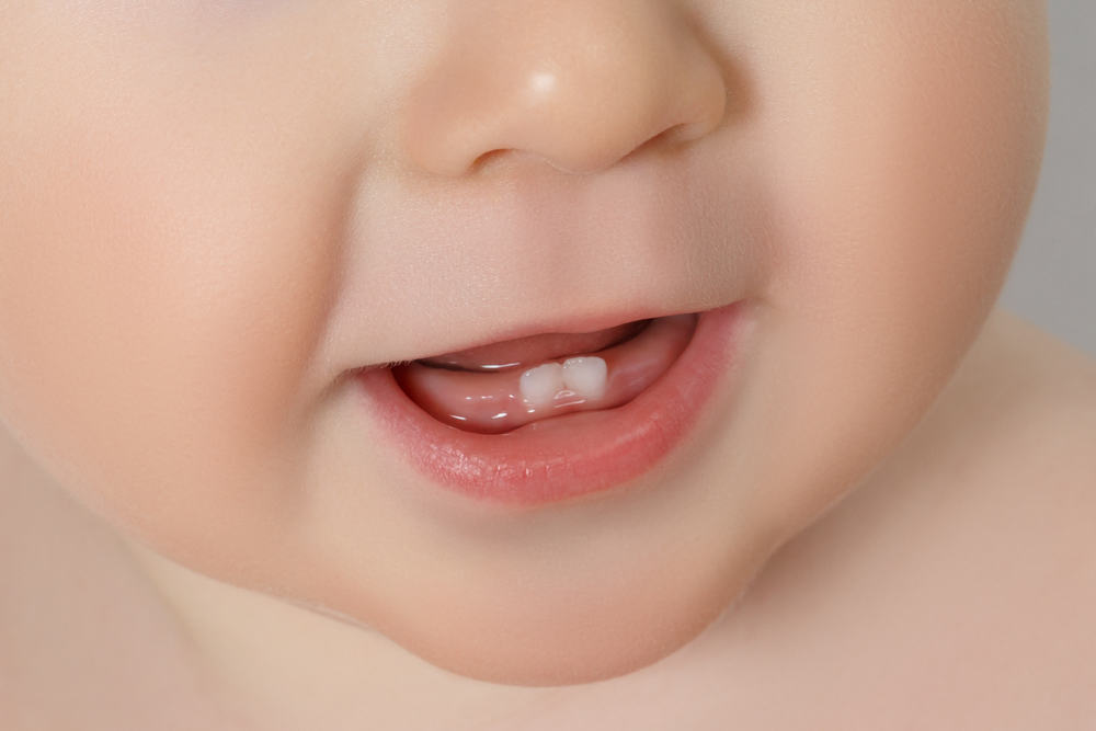 Gambar bayi sedang demam semasa proses tumbuh gigi