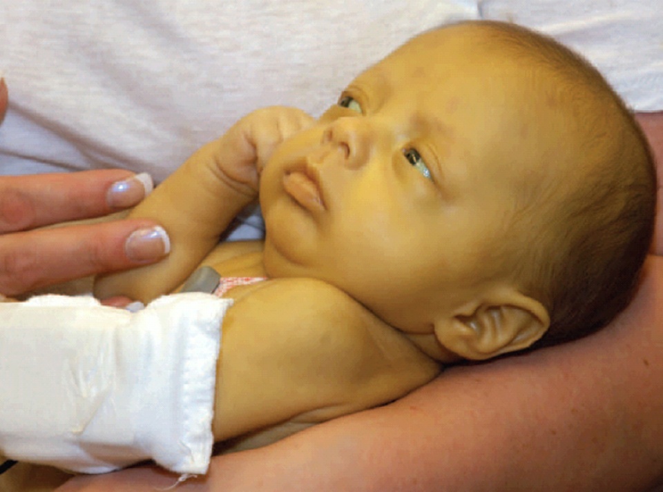 bacaan normal jaundice bayi