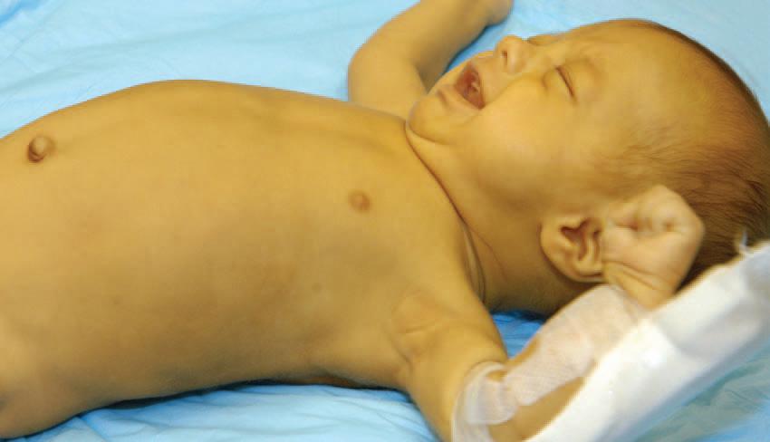 bacaan normal jaundice bayi