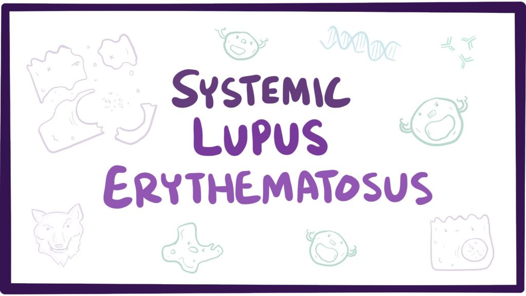 penyakit lupus