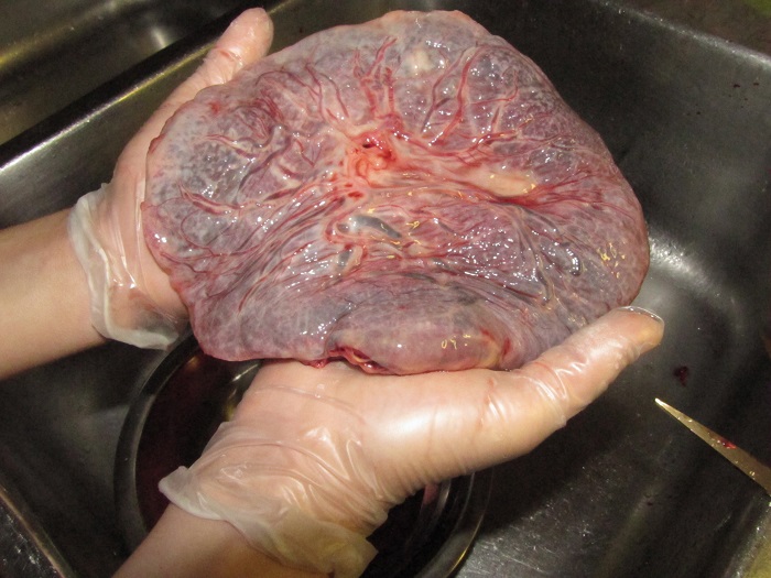 Gambar uri (placenta) yang akan dibasuh dan ditanam mengikut syariat Islam.