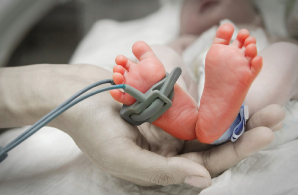 Gambar bayi pramatang yang dilahirkan awal sebelum tempoh cukup bulan
