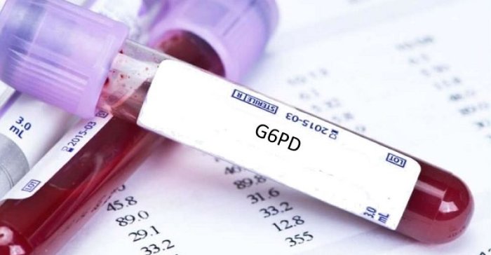 Bayi baru lahir dirawat di hospital berkaitan ujian dan simptom kekurangan enzim G6PD.