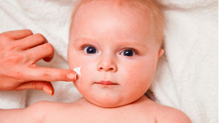 ubat eczema untuk bayi