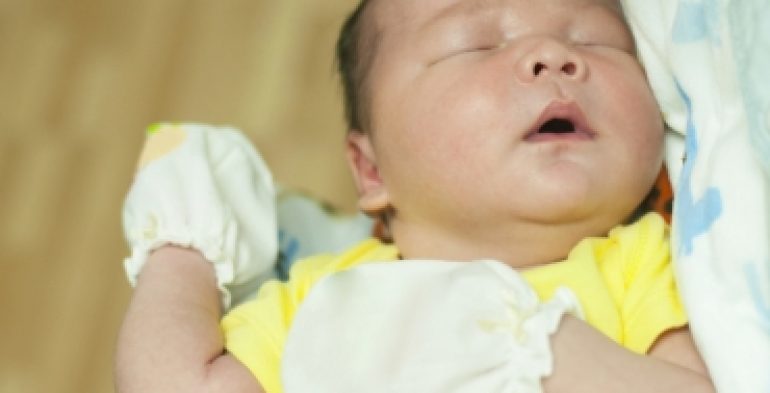 Bayi baru dilahirkan sedang diletakkan di bawah lampu fototerapi di hospital