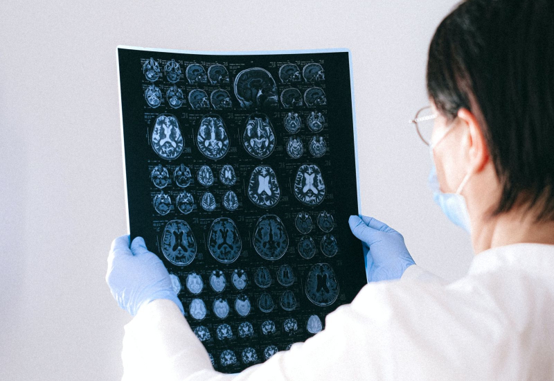 Doktor memeriksa imbasan otak kanak-kanak