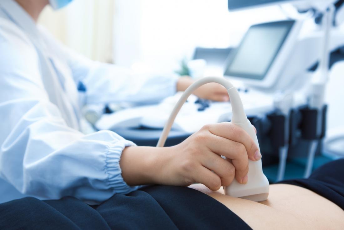Imbasan ultrasound menunjukkan kantung bayi kosong tanpa janin di dalam rahim