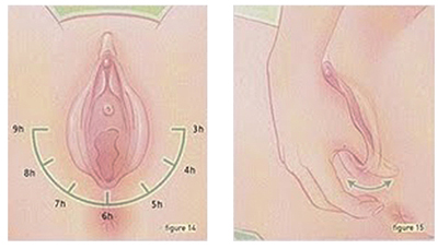 9 langkah urutan perineum